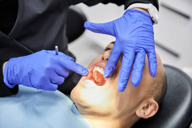 Best Knocked-Out Tooth Emergency  in Indianola, WA